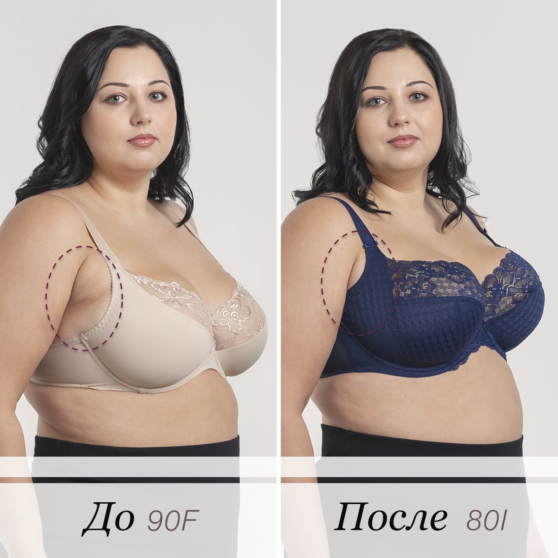 До и после бра-фиттинга: 90F и 80I